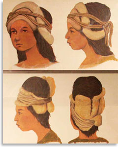 Стягивающие повязки для деформации головы