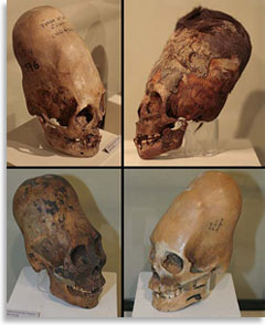 Черепа удлиненной формы в Региональном музее Ики